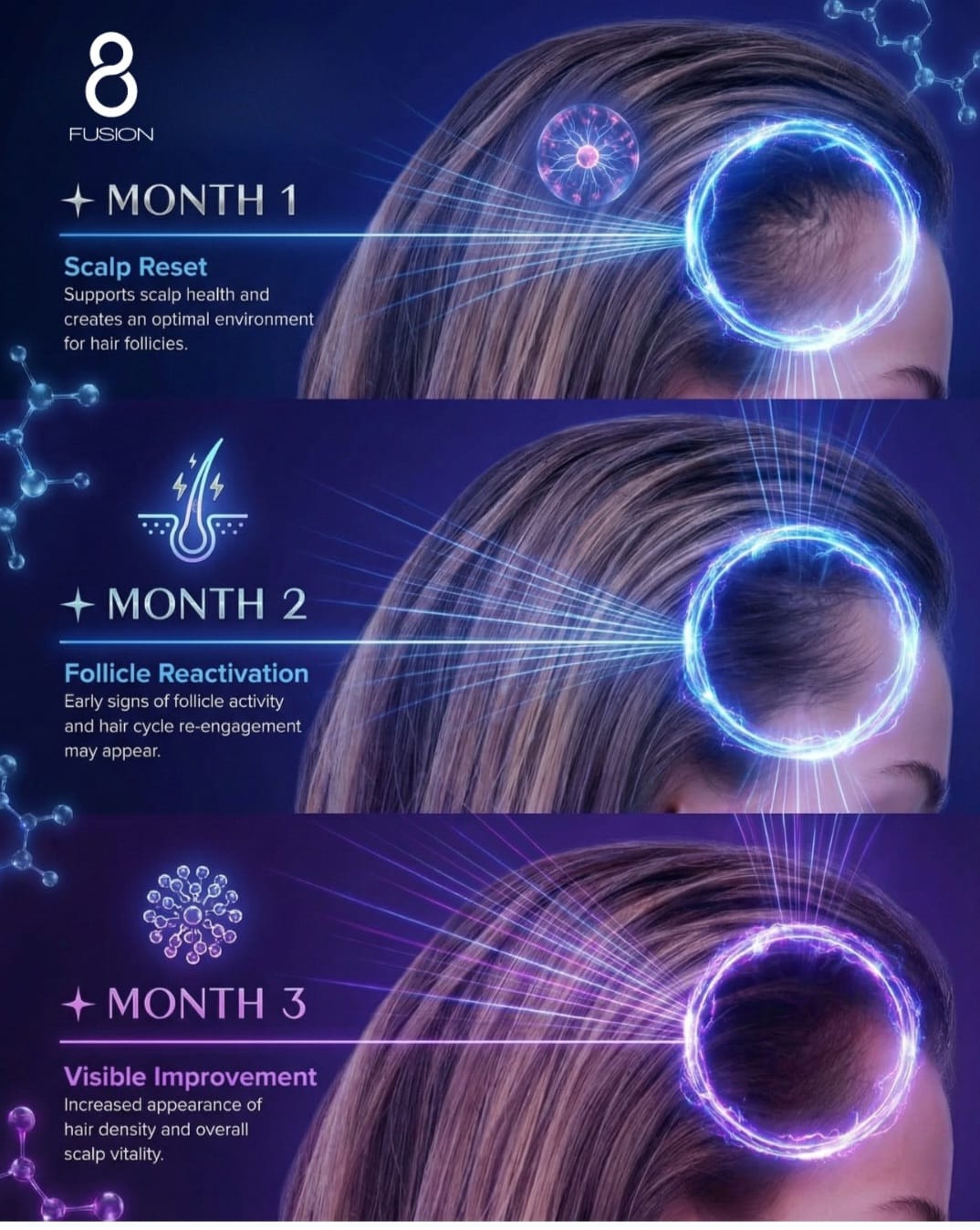 Fusion8 scalp reset and hair restoration timeline across three months