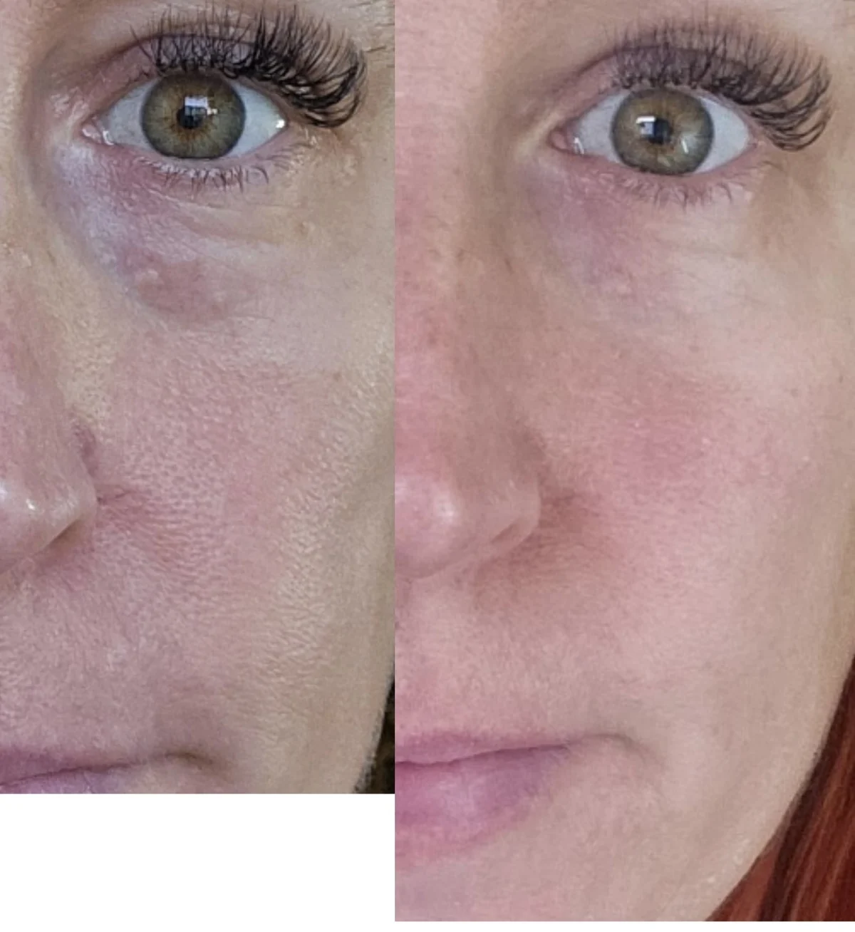 Treatment Result before and after
